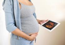 孕妇补充维生素A要小心过量